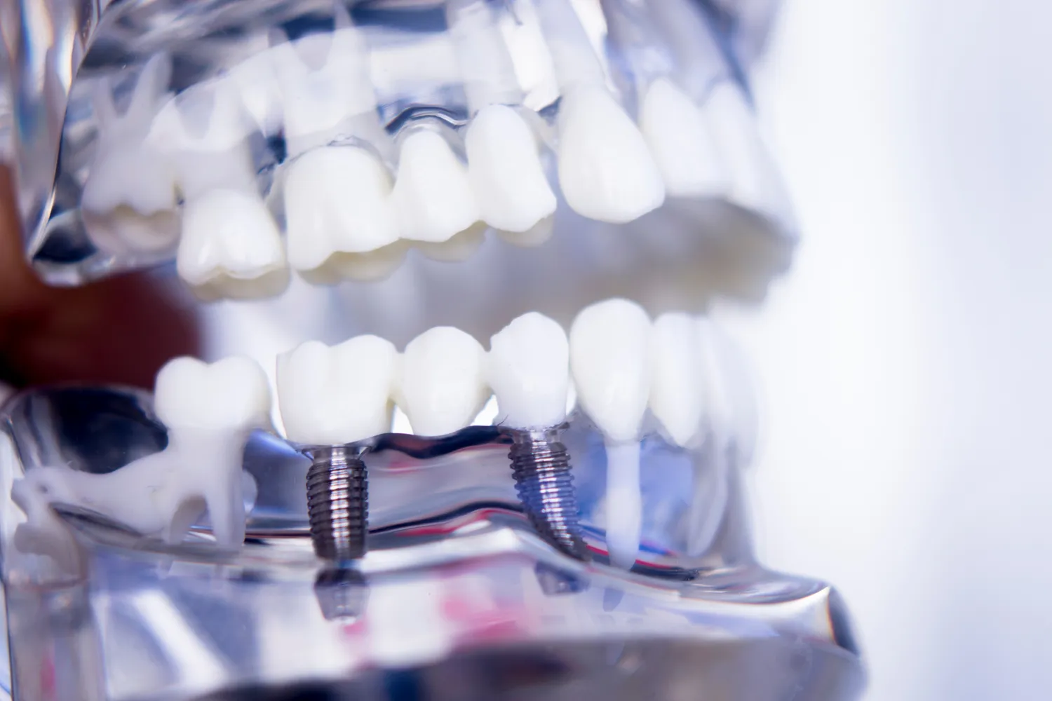 Dentysta czy stomatolog?